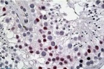 DENTT/CDA1 Antibody
