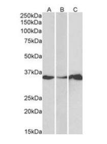 LASP1 (N Terminus) Antibody