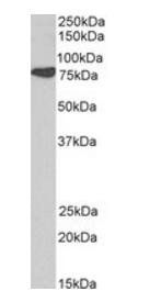 Cortactin/EMS1 Antibody