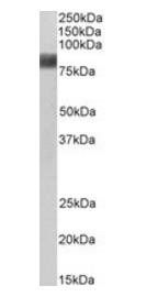 Cortactin/EMS1 Antibody