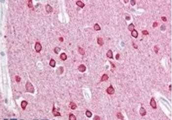 PACSIN1 Antibody