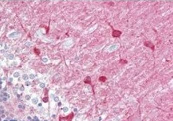 PACSIN1 Antibody