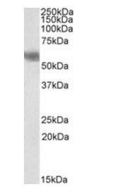 DUSP8/HVH5 Antibody