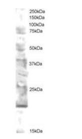 UEV2V2/MMS2 Antibody