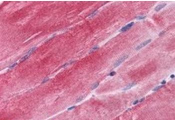 Goat anti-BAG3 / BIS/ CAIR1 Antibody