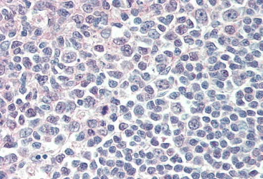 ICSBP1/IRF8 Antibody