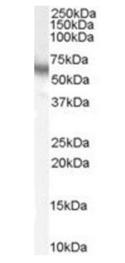 p70S6K/RPS6KB1 Antibody