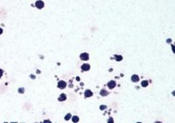 CIAS1/cryopyrin ( C Terminus) Antibody
