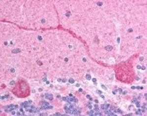 CHFR Antibody