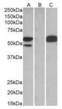 Goat anti-SSA1 / Ro52 Antibody