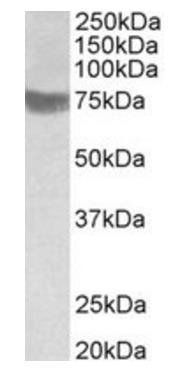 TRC8 Antibody