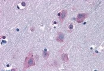 TRIM2 Antibody