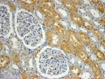 APXL Antibody