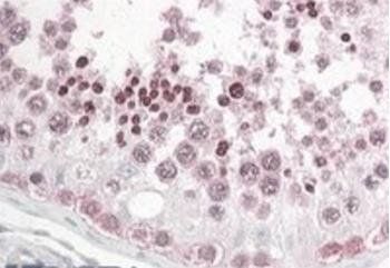 INADL/PATJ Antibody