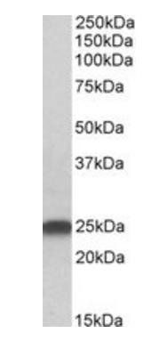 LIN7B/MALS-2 Antibody