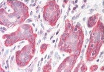PDLIM4/RIL Antibody