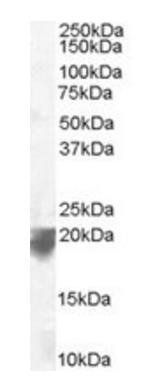 VPS29 (C Terminus) Antibody