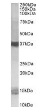 Prefoldin Antibody