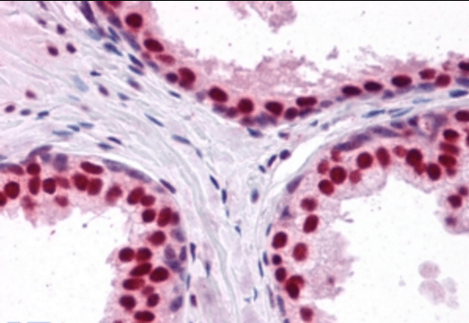DDX5/p68 RNA helicase Antibody