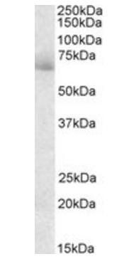AKAP10/D-AKAP2 Antibody