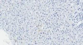 FENS1/WDFY1 Antibody