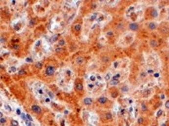 FENS1/WDFY1 Antibody