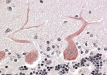 Cdc42-binding kinase alpha Antibody