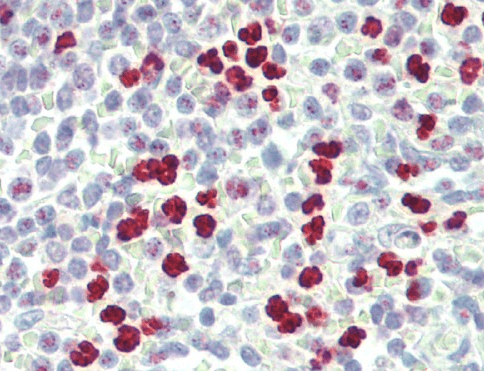 Goat anti-PAD4 / PADI4 Antibody