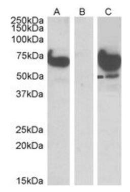 EPM2A (laforin) IP1 Antibody