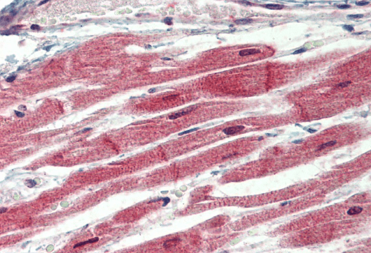 IRAK4 (N Terminus) Antibody