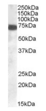 HIP14L/ZDHHC13 Antibody