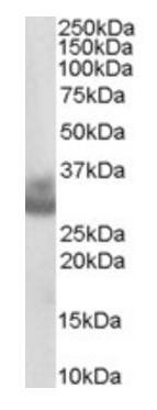Cathepsin F Antibody