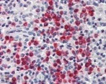 Goat anti-Lipocalin 2 / NGAL Antibody