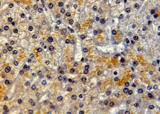 LRP5 Antibody