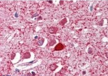 Goat anti-Parvalbumin Antibody