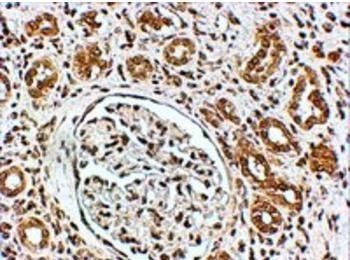 VPS41 Antibody