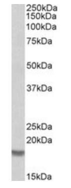 Cofilin 2 (muscle) Antibody