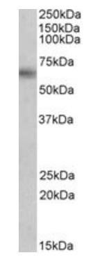 MAOB Antibody