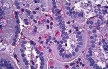 Netrin 1 Antibody