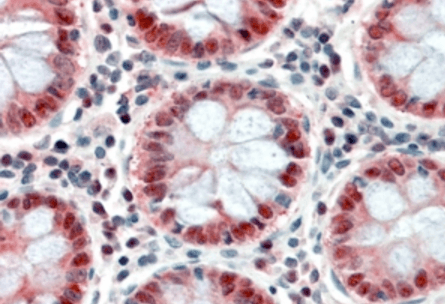 PTCH (C Terminus) Antibody