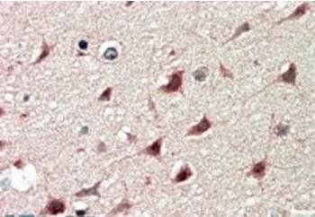 DCDC2 Antibody