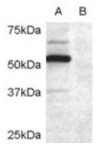 DCDC2 Antibody