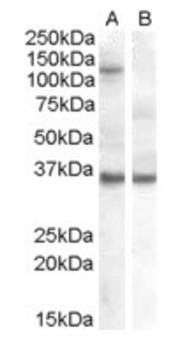 EIF2C1/AGO1 Antibody