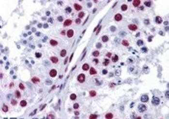 NONO/p54NRB Antibody