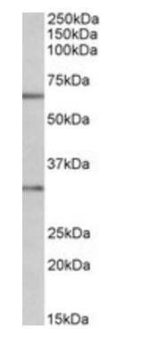 Caspase 3 Antibody