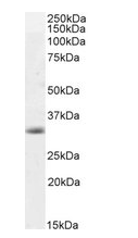 Caspase 3 Antibody