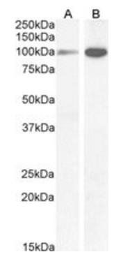 NMDA receptor 1/GRIN1 Antibody