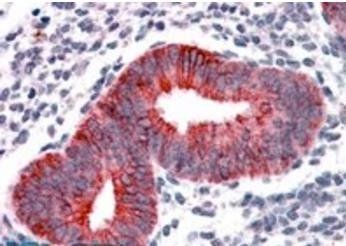 VPS29 (Internal) Antibody