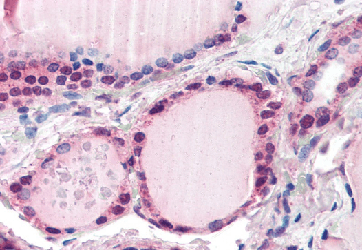 FBXL3 Antibody