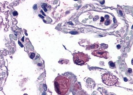 FLAP/ALOX5AP (internal) Antibody